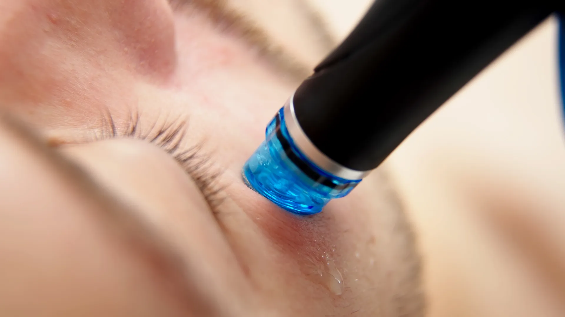 Hydrafacial Treatment treatment at Everis Aesthetic Medicine in Milpitas, CA