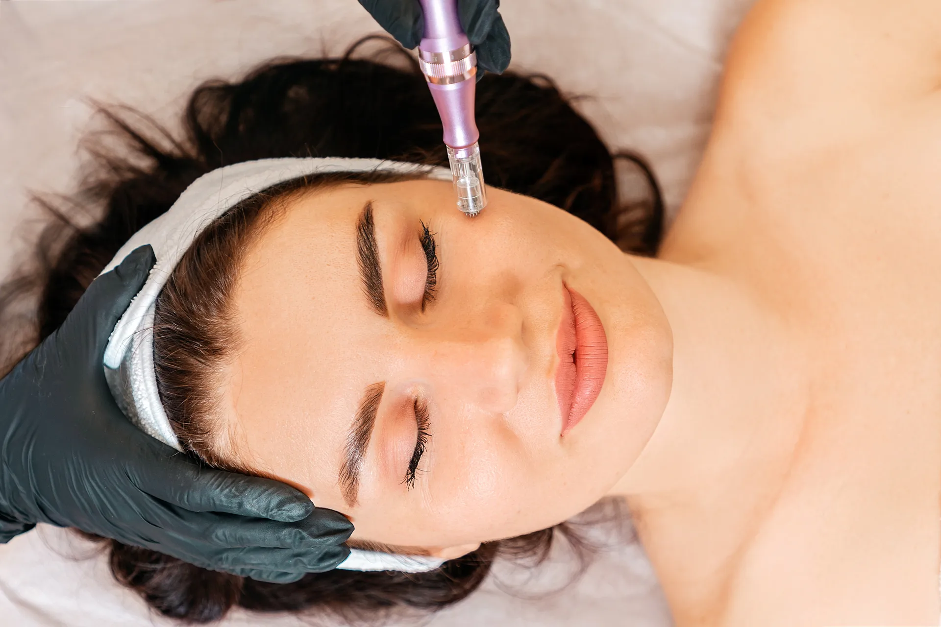 Microneedling treatment at Everis Aesthetic Medicine in Milpitas, CA