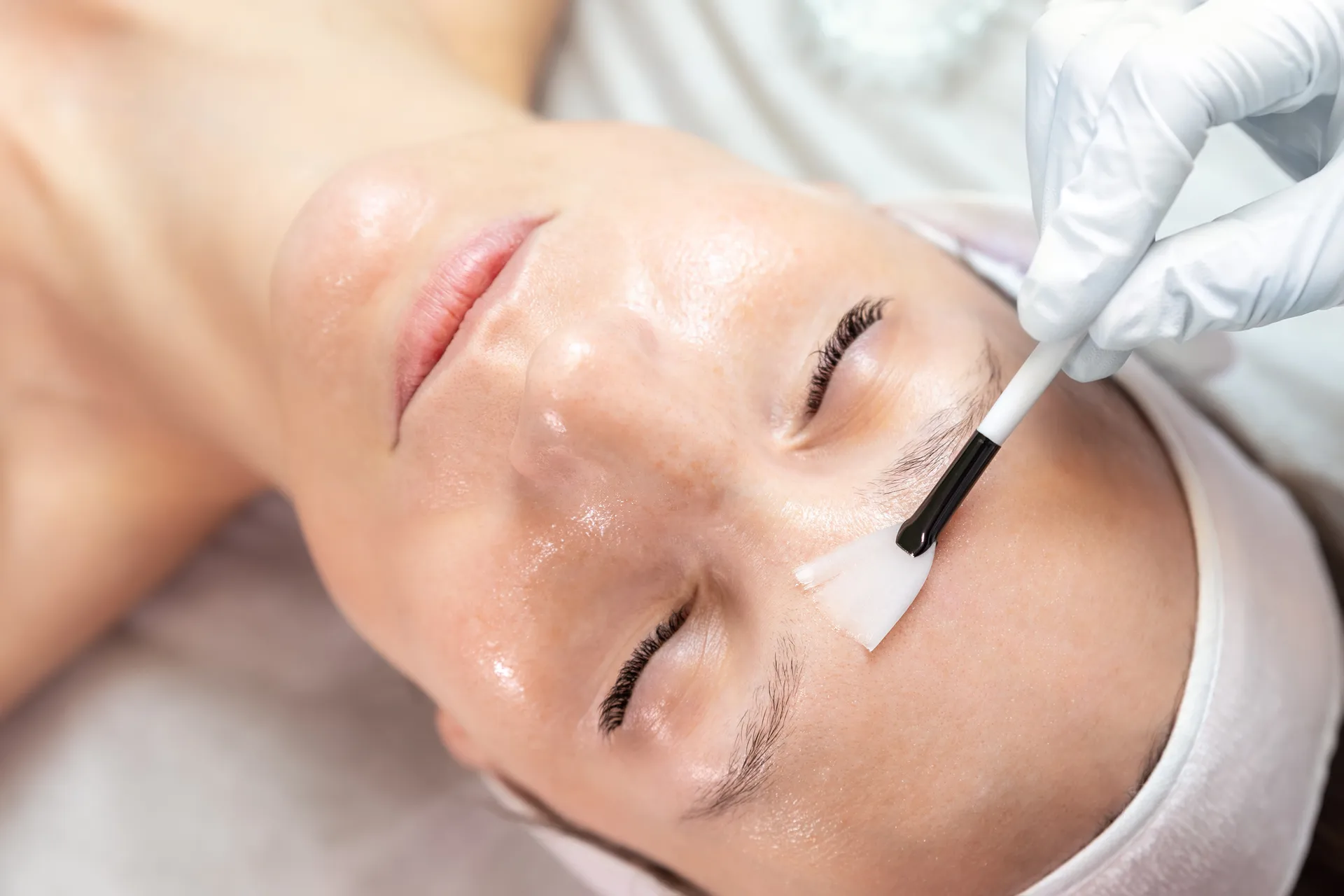 VI Chemical Peels at Everis Aesthetic Medicine in Milpitas, CA
